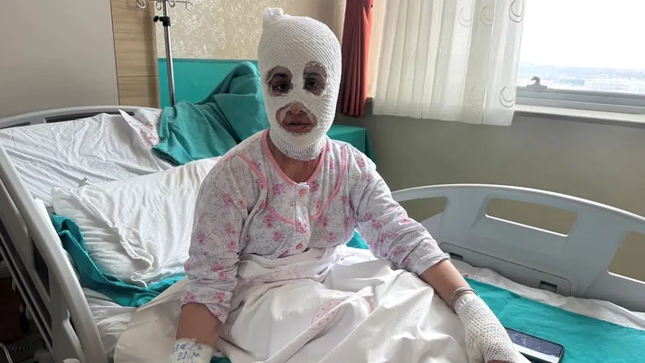 Ağrı'da iftar öncesi düdüklü tencere patladı, 2 çocuk annesi kadın yaralandı