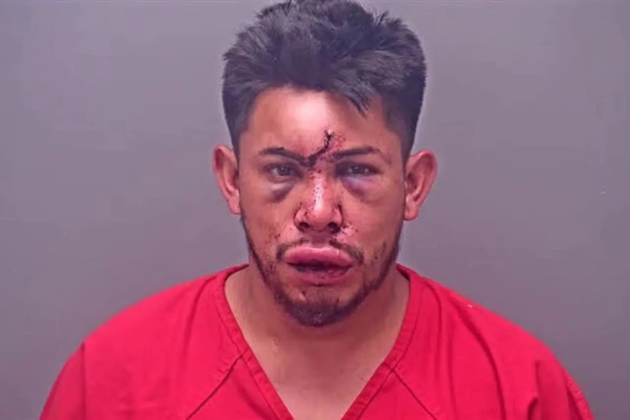 13 yaşındaki çocuk, evdeki olayı görünce babasını dövdü