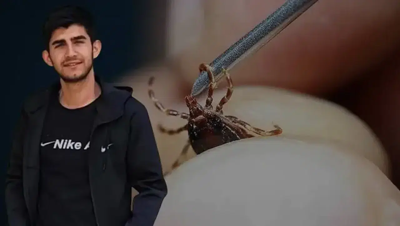 21 yaşındaki genç kene nedeniyle hayatını kaybetti