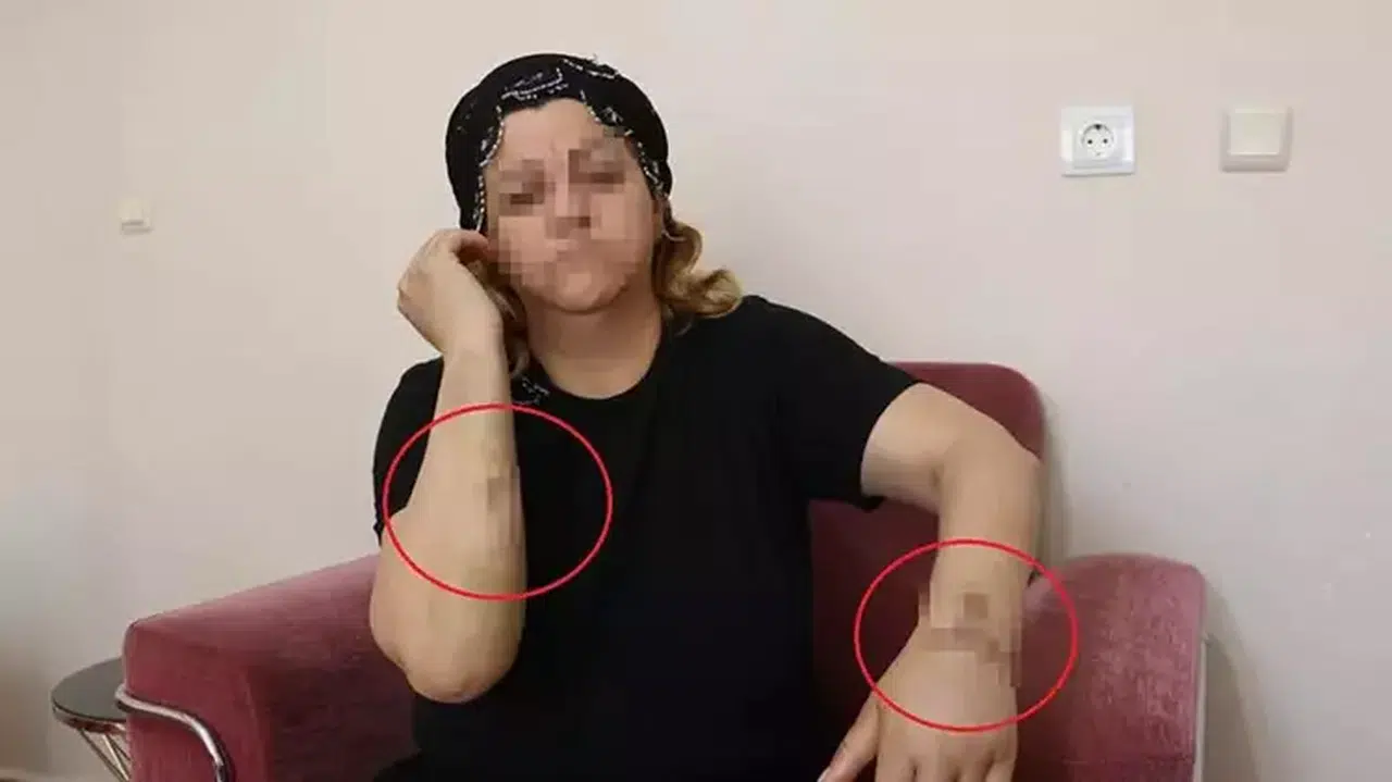 16 yıl birlikte yaşadığı kişi tarafından 30 yerinden bıçaklandı