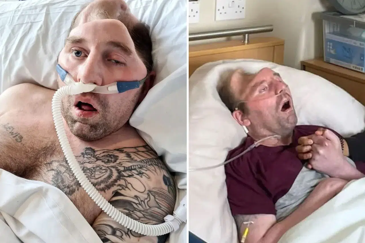 Tek darbeyle hayatı değişti: Verilen ceza yok artık dedirtti