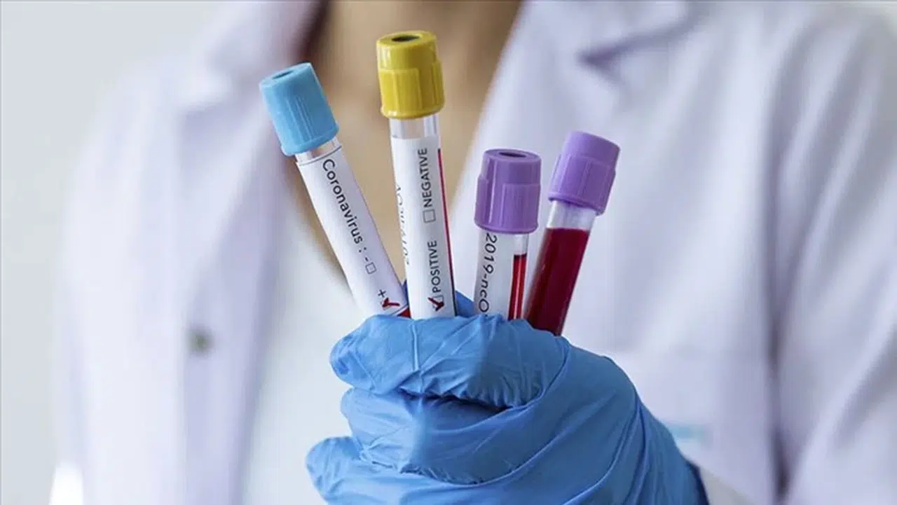 DSÖ Ebola salgınının risk düzeylerini açıkladı