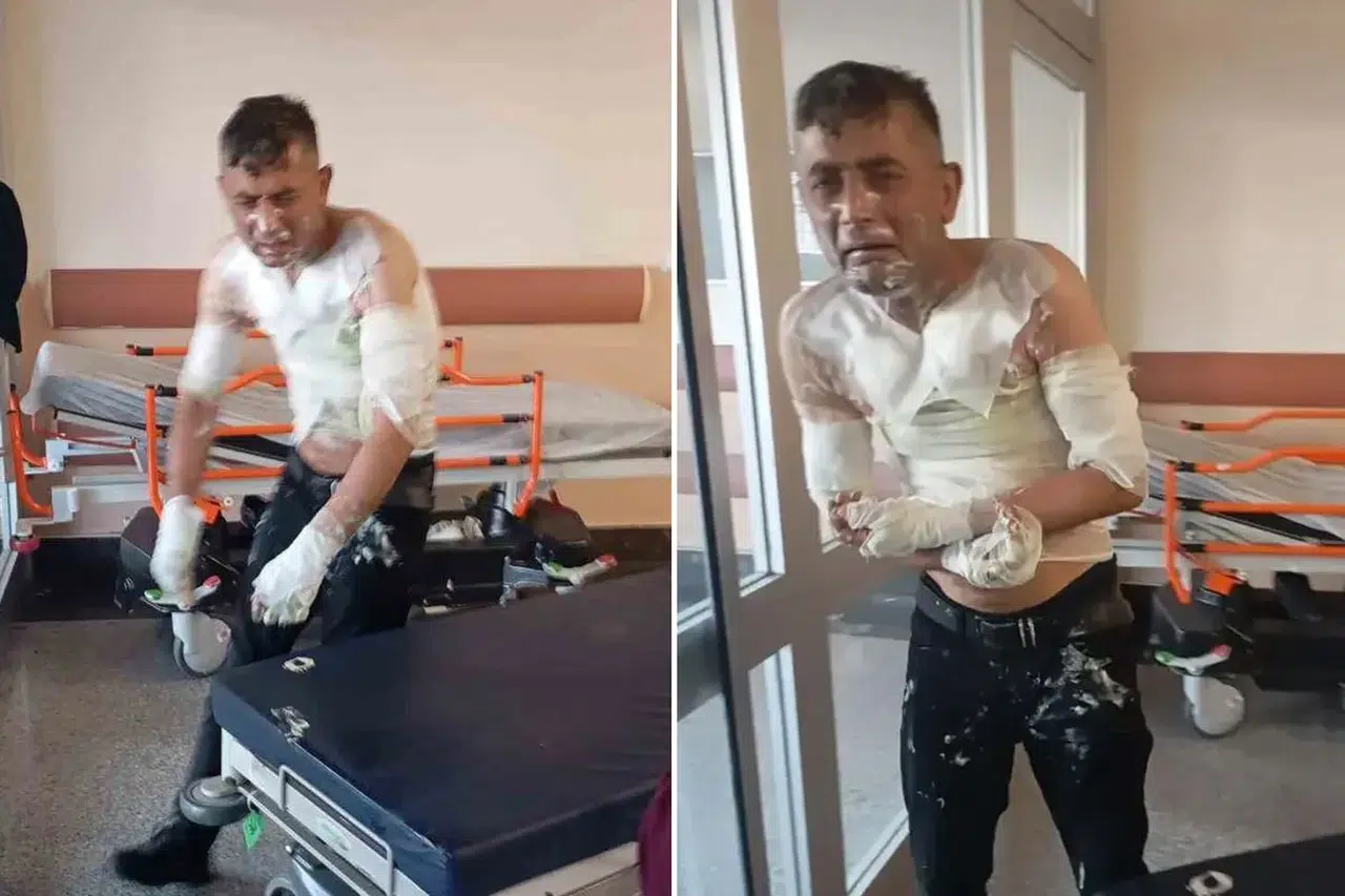 Gaziosmanpaşa’da engelli vatandaşa korkunç saldırı benzin döküp yaktı