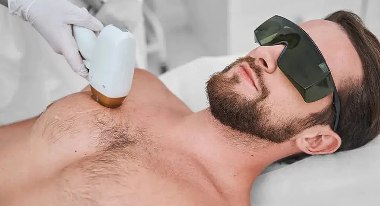 Erkekler İçin Lazer Epilasyon Rehberi