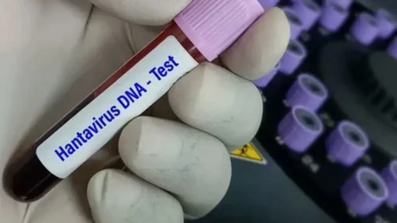 DSÖ’den gemide ortaya çıkan hantavirüs için “risk düşük” açıklaması