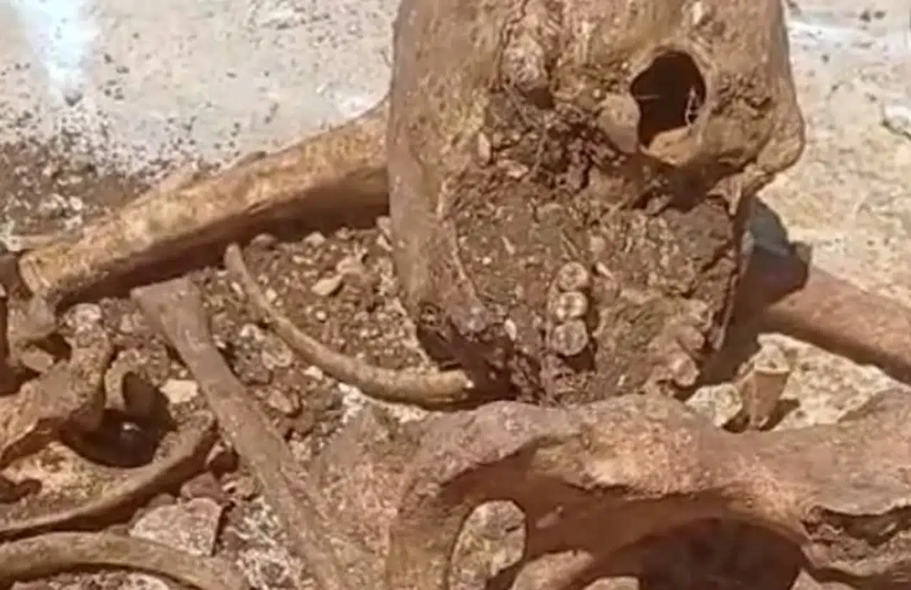 Malatya'da temel kazısı sırasında insan kemikleri bulundu