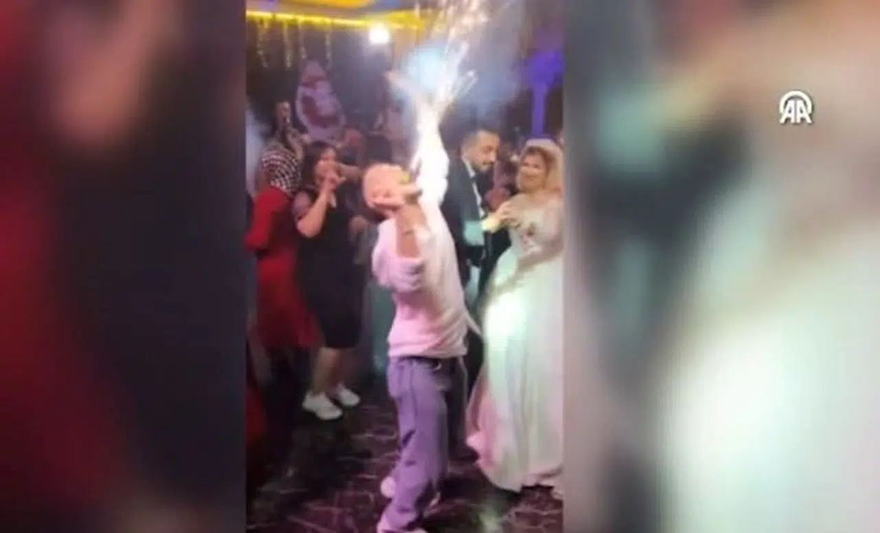 Ankara'daki düğünde korku dolu anlar! Ağzındaki meşale yüzünde patladı