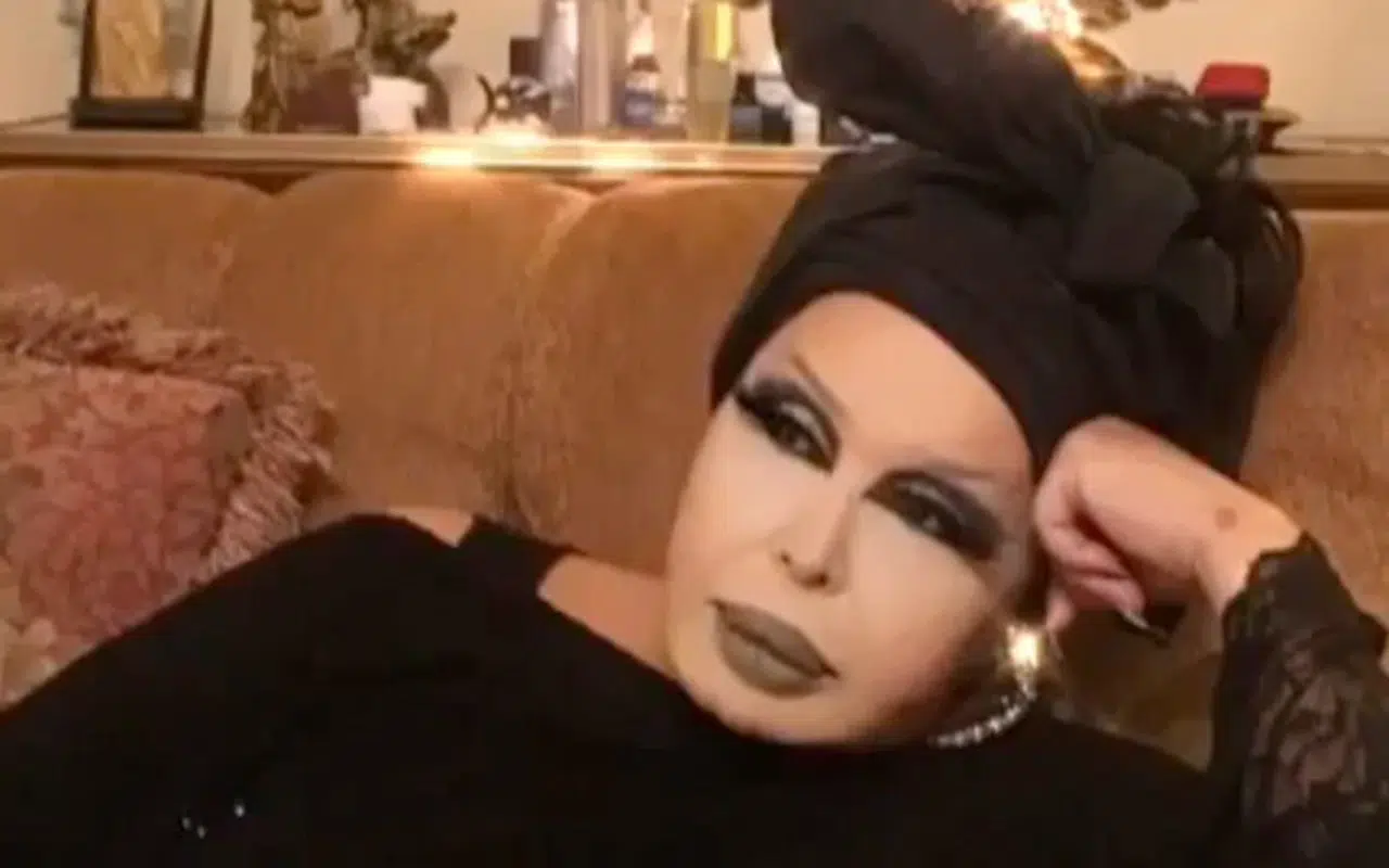 'Lolita Lift' operasyonu yaptıran Bülent Ersoy'un son haline yorum yağdı