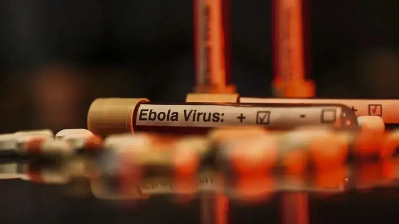 KDC’de Ebola salgını: Can kaybı 3 bini aştı