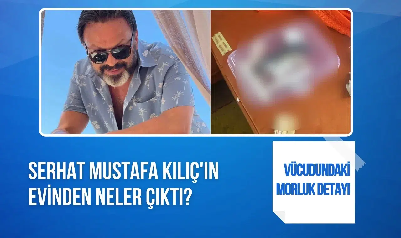 Serhat Mustafa Kılıç evinde ölü bulundu: Vücudundaki morluklar dikkat çekti