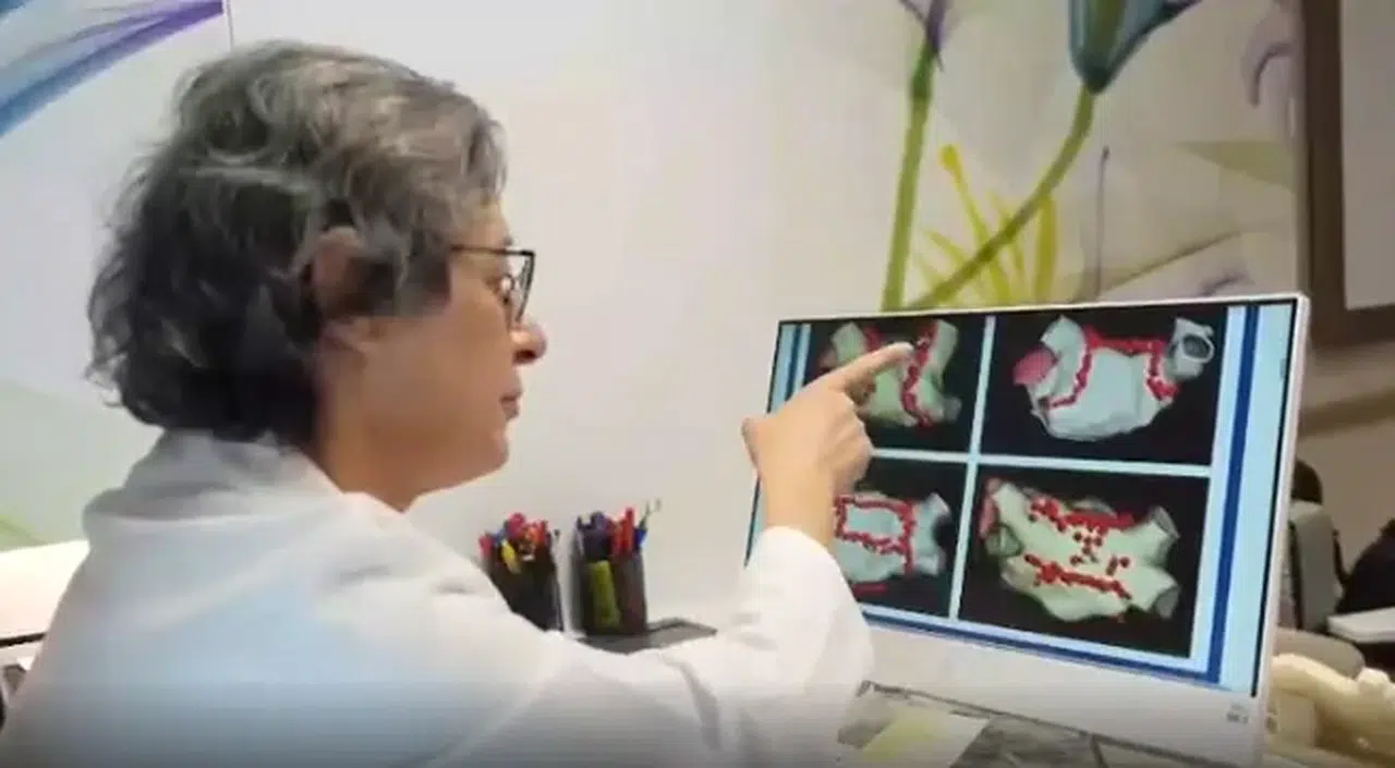 Kalpteki ritim bozukluğu inme riskini 5 kat artırıyor! Uzmanından kritik uyarı