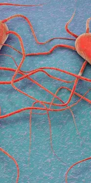 Listeria bakterisi nerede gizleniyor? Hangi besinlerden bulaşır ve belirtileri neler?