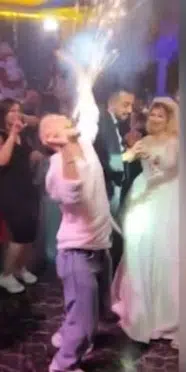Ankara'daki düğünde korku dolu anlar! Ağzındaki meşale yüzünde patladı