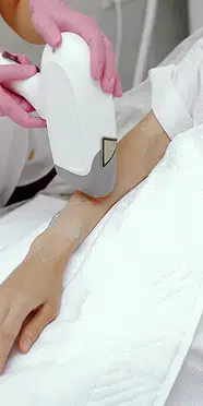 İzmir Lazer Epilasyon Merkezi Seçerken Nelere Dikkat Edilmelidir?