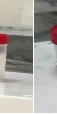 Çeşme suyu tüketenler dikkat! Boğazından çıkanları görenler şaşkına döndü