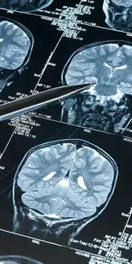 Uzmanlar açıkladı: Derin uyku Alzheimer'ın ilerlemesini yavaşlatabilir