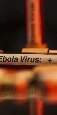 KDC’de Ebola salgını: Can kaybı 3 bini aştı