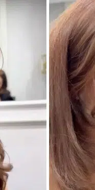 Tuğçe Yakar kimdir, neden gündemde? Dilan Polat'ın desteği ve estetik sonrası yeni görüntüsü sosyal medyada konuşuldu!