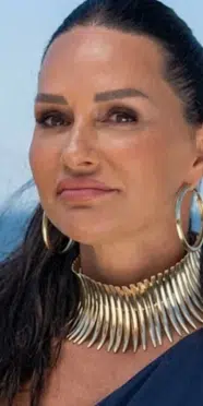 Yasemin Ergene'nin yıllar içindeki değişimine estetik cerrahtan değerlendirme