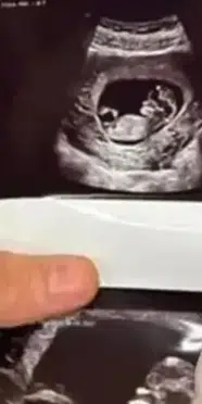 Kovacs kimdir, kaç yaşında ve Ufuk Beydemir ile sevgilisi Sharon Kovacs bebek mi bekliyor?