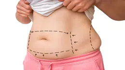 Liposuction Mucizesi ile Diyetin Bitiremediği Yağlar Tek Seansta Eriyor