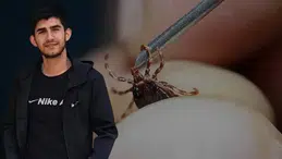 21 yaşındaki genç kene nedeniyle hayatını kaybetti