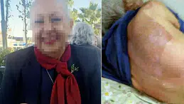 Yaşlı kadının ölümüne neden olan doktora para cezası verildi