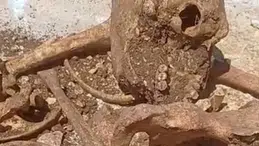 Malatya'da temel kazısı sırasında insan kemikleri bulundu