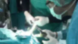 3 yaşındaki çocuk 25 mıknatıslı top yuttu: 21 parça operasyonla çıkarıldı