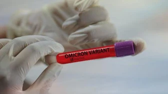 Uzmanlar açıkladı: Zayıf bireyler Covid-19’u daha ağır geçiriyor