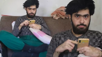 3 yıldır tırnaklarını kesmeyen ve duş almayan gencin eski hali ortaya çıktı