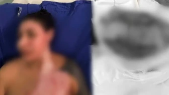 Kadıköy’de dehşet: 33 yaşındaki kadın yanıcı maddeyle ateşe verildi