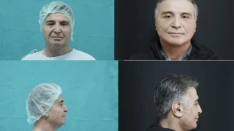 Bitlis Devlet Hastanesi’nde bir ilk gerçekleşti: Estetikte yeni dönem