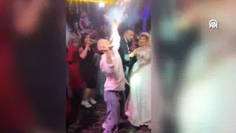Ankara'daki düğünde korku dolu anlar! Ağzındaki meşale yüzünde patladı