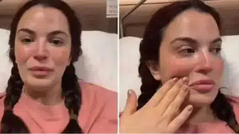Aslı Bekiroğlu 9. kez bıçak altına yatacak: Nedenini açıkladı