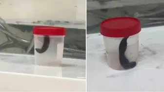 Çeşme suyu tüketenler dikkat! Boğazından çıkanları görenler şaşkına döndü