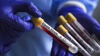 Dünya Sağlık Örgütü açıkladı: Kongo’daki salgında 3 bin 267 kişi öldü