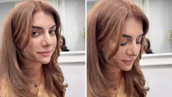 Tuğçe Yakar kimdir, neden gündemde? Dilan Polat'ın desteği ve estetik sonrası yeni görüntüsü sosyal medyada konuşuldu!