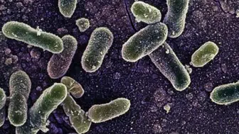 Belçika’da Salmonella salgını: Vaka sayısı 318’e yükseldi