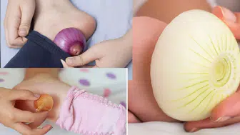 Çorabın içine soğan koyup uyumak faydalı mı? İşte gerçekler