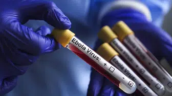 Afrika'da ebola salgını: Sağlık Bakanları olağanüstü toplanıyor