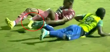 Motagua’da korkutan sakatlık: Genç futbolcunun maçta bacağı kırıldı
