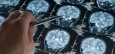 Uzmanlar açıkladı: Derin uyku Alzheimer'ın ilerlemesini yavaşlatabilir