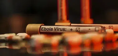 KDC’de Ebola salgını: Can kaybı 3 bini aştı