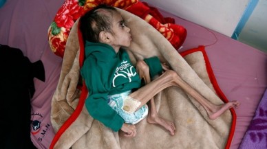 İnsan hakları savunucuları BM ve AB sınıfta kaldı! Yemen'de insani kriz!