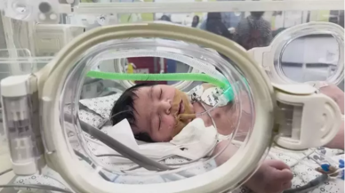 Dünya 'mucize bebek' olarak ondan bahsediyor!