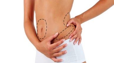 Liposuction Nedir ve İşlemi Nasıl Gerçekleşir?