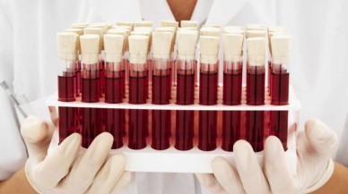 Bilim dünyası son noktayı koydu: İşte en zeki insanların kan grubu!