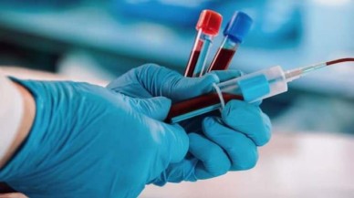 Kan grubuna göre ne kadar zekisin? İşte en yükse IQ'ya sahip kan grubu...