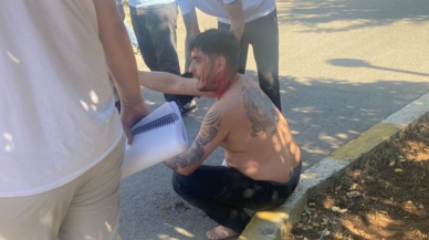 Dizi setine silahlı saldırı! Cengo rolüyle tanınan oyuncu  başından yaralandı